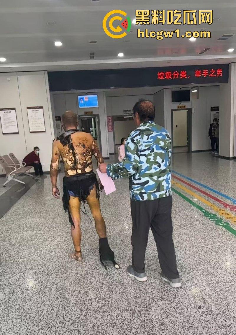 江苏常州易化工厂油罐爆炸 现场员工大面积烧伤 场面骇人 现场视频曝光皮都烧掉了-10