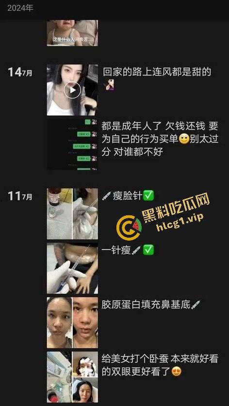 每个人体质不一样!瘦脸医美针害死人!肉毒整容 那女的 变 那女神!-9