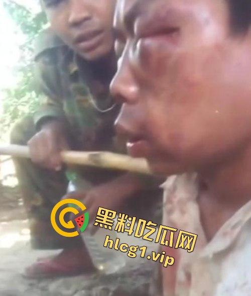缅甸妙瓦底军阀虐待人质视频曝光,男子被殴打至面目全非,血迹斑斑的恐怖真相!-3