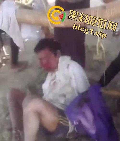 缅甸妙瓦底军阀虐待人质视频曝光,男子被殴打至面目全非,血迹斑斑的恐怖真相!-4