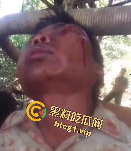 缅甸妙瓦底军阀虐待人质视频曝光,男子被殴打至面目全非,血迹斑斑的恐怖真相!-6